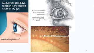 Eye lids | PPTX