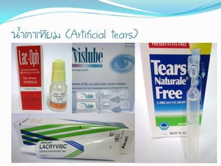 น้้าตาเทียม (Artificial tears)
 