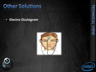 Other SolutionsElectro-Oculogram11Technical View