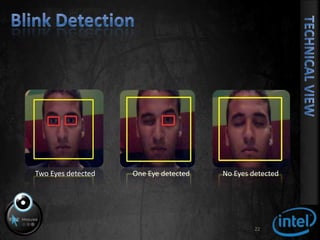 Blink Detection22Two Eyes detectedOne Eye detectedNo Eyes detectedTechnical View
