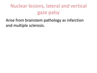 Nuclear lesions, lateral and vertical
gaze palsy
Arise from brainstem pathology as infarction
and multiple sclerosis.

 