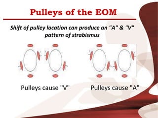 Pulleys of the EOM
Shift of pulley location can produce an "A" & "V"
pattern of strabismus
Pulleys cause "V" Pulleys cause "A"
 