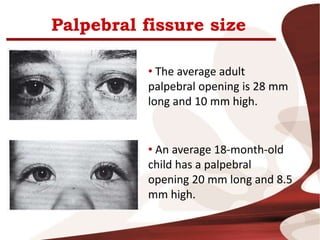 Palpebral fissure size
• The average adult
palpebral opening is 28 mm
long and 10 mm high.
• An average 18-month-old
child has a palpebral
opening 20 mm long and 8.5
mm high.
 
