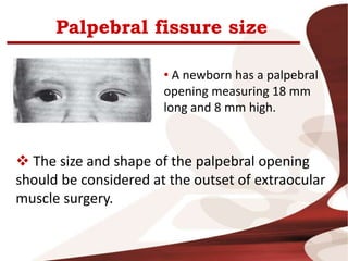 Palpebral fissure size
• A newborn has a palpebral
opening measuring 18 mm
long and 8 mm high.
 The size and shape of the palpebral opening
should be considered at the outset of extraocular
muscle surgery.
 