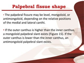Palpebral fissue shape
• The palpebral fissure may be level, mongoloid, or
antimongoloid, depending on the relative positions
of the medial and lateral canthi.
• If the outer canthus is higher than the inner canthus,
a mongoloid palpebral slant exists (Figure 15). If the
outer canthus is lower than the inner canthus, an
antimongoloid palpebral slant exists.
 