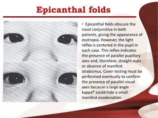 Epicanthal folds
• Epicanthal folds obscure the
nasal conjunctiva in both
patients, giving the appearance of
esotropia. However, the light
reflex is centered in the pupil in
each case. This reflex indicates
the presence of parallel pupillary
axes and, therefore, straight eyes
or absence of manifest
strabismus. Cover testing must be
performed eventually to confirm
the presence of parallel visual
axes because a large angle
kappa* could hide a small
manifest esodeviation.
 