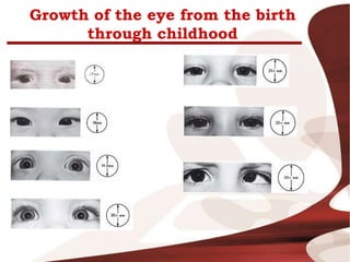 Growth of the eye from the birth
through childhood
 