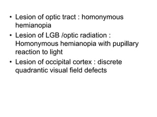 • Lesion of optic tract : homonymous
hemianopia
• Lesion of LGB /optic radiation :
Homonymous hemianopia with pupillary
reaction to light
• Lesion of occipital cortex : discrete
quadrantic visual field defects
 