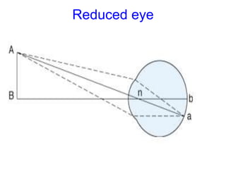 Reduced eye
 