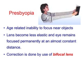 Presbyopia
• Age related inability to focus near objects
• Lens become less elastic and eye remains
focused permanently at an almost constant
distance.
• Correction is done by use of bifocal lens
 