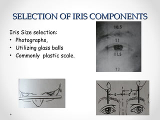 SELECTION OF IRIS COMPONENTS
SELECTION OF IRIS COMPONENTS
Iris Size selection:
• Photographs,
• Utilizing glass balls
• Commonly plastic scale.
 