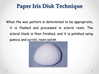 Paper Iris Disk Technique
Paper Iris Disk Technique
When the wax pattern is determined to be appropriate,
it is flasked and processed in scleral resin. The
scleral blank is then finished, and it is polished using
pumice and acrylic resin polish
 