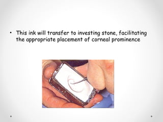 • This ink will transfer to investing stone, facilitating
the appropriate placement of corneal prominence
 