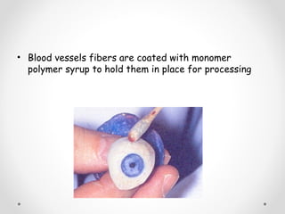 • Blood vessels fibers are coated with monomer
polymer syrup to hold them in place for processing
 