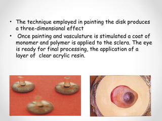• The technique employed in painting the disk produces
a three-dimensional effect
• Once painting and vasculature is stimulated a coat of
monomer and polymer is applied to the sclera. The eye
is ready for final processing, the application of a
layer of clear acrylic resin.
 
