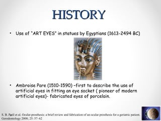 HISTORY
HISTORY
• Use of “ART EYES” in statues by Egyptians (1613-2494 BC)
• Ambroise Pare (1510-1590) –first to describe the use of
artificial eyes in fitting an eye socket ( pioneer of modern
artificial eyes)- fabricated eyes of porcelain.
S. B. Patil et al. Ocular prosthesis: a brief review and fabrication of an ocular prosthesis for a geriatric patient.
Gerodontology 2008; 25: 57–62
 