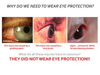 WHY DO WE NEEDTO WEAR EYE PROTECTION?
This injury was caused by a
grinding spark.
This injury was caused by a
wire brush.
Again....wire brush. While
he was cleaning shutters.
What do all these injuries have in common?
THEY DID NOTWEAR EYE PROTECTION!!
 