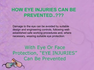 Eye Protection | PPTX