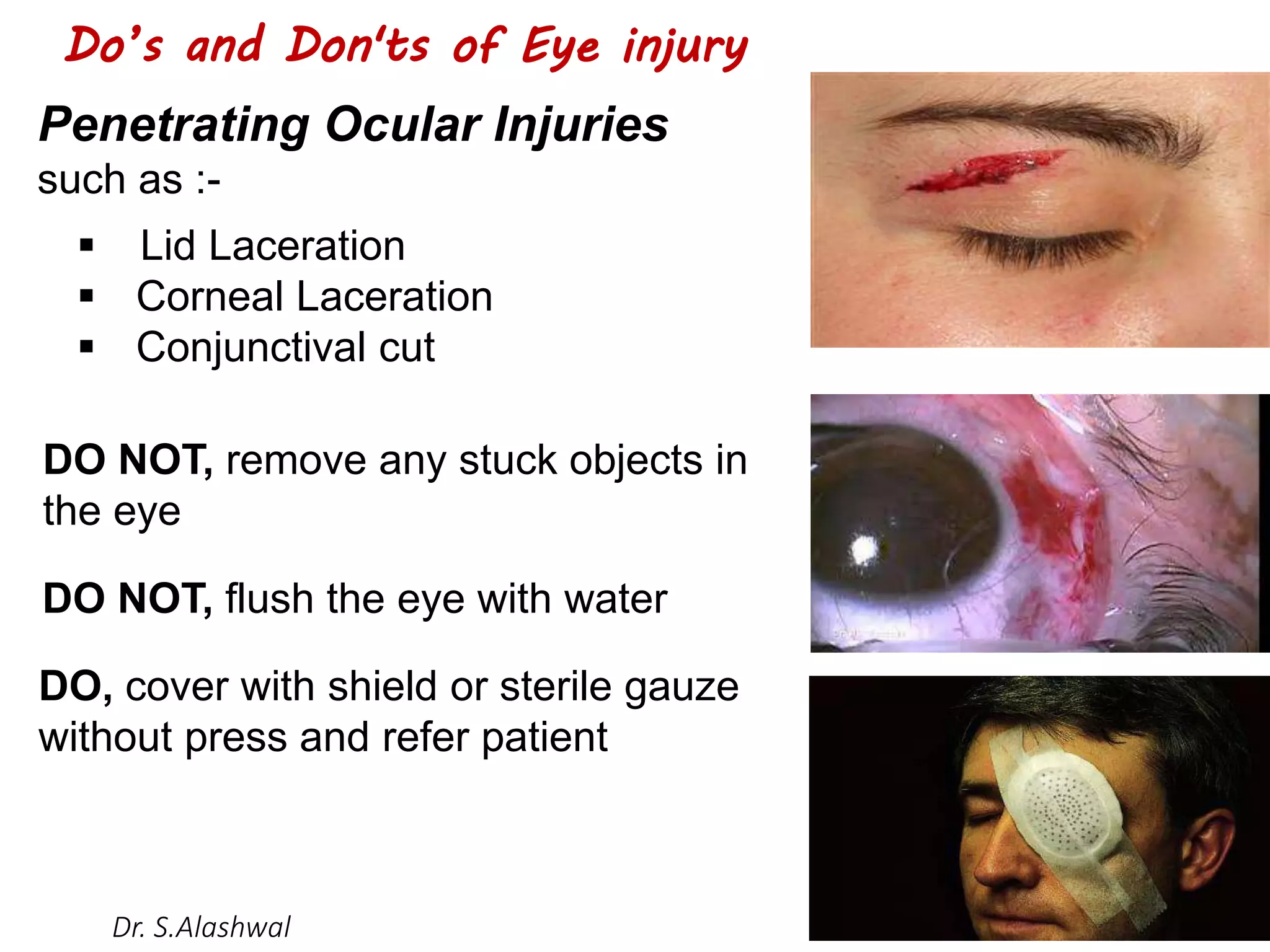 Incorrect Eye Protection Eye protection in workplace | PDF