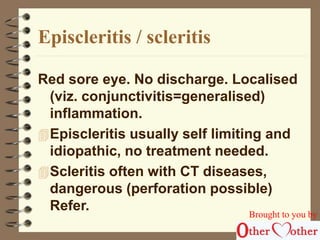 Episcleritis / scleritis 
Red sore eye. No discharge. Localised 
(viz. conjunctivitis=generalised) 
inflammation. 
Episcleritis usually self limiting and 
idiopathic, no treatment needed. 
Scleritis often with CT diseases, 
dangerous (perforation possible) 
Refer. 
Brought to you by 
 
