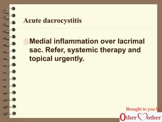 Acute dacrocystitis 
Medial inflammation over lacrimal 
sac. Refer, systemic therapy and 
topical urgently. 
Brought to you by 
 