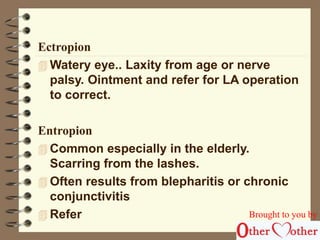 Ectropion 
Watery eye.. Laxity from age or nerve 
palsy. Ointment and refer for LA operation 
to correct. 
Entropion 
Common especially in the elderly. 
Scarring from the lashes. 
 Often results from blepharitis or chronic 
conjunctivitis 
 Refer Brought to you by 
 