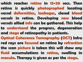 which reaches retina in 15-20 secs. Then
retina is quickly photographed locating
vessel deformities, leakages, closed blood
vessels in retina. Developing new blood
vessels allied info can be gathered. This help
to understand the progress, degeneration
and stage of retinopathy in patients.
Optical Coherence Tomography (OCT) Infra
red rays are focused on retina by refraction
the scan picture is taken this will show any
fluid accumulations in retina, swelling in
macula. Therapy is given as per the stage.
 