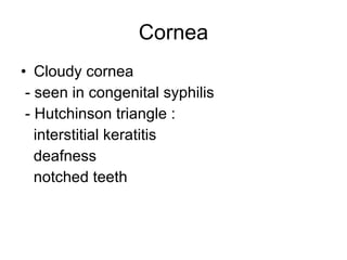 Cornea Cloudy cornea - seen in congenital syphilis - Hutchinson triangle : interstitial keratitis deafness notched teeth 