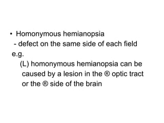 Homonymous hemianopsia - defect on the same side of each field e.g.  (L) homonymous hemianopsia can be caused by a lesion in the ® optic tract or the ® side of the brain 