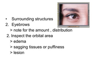 Surrounding structures Eyebrows  > note for the amount , distribution 2. Inspect the orbital area  > edema > sagging tissues or puffiness > lesion 
