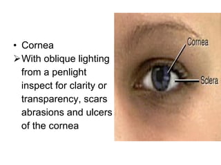 Cornea  With oblique lighting from a penlight inspect for clarity or transparency, scars abrasions and ulcers of the cornea 