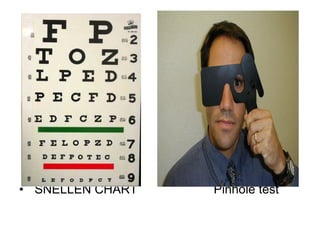SNELLEN CHART  Pinhole test 
