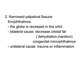 2. Narrowed palpebral fissure: Enophthalmos - the globe is recessed in the orbit - bilateral cause: decrease orbital fat  ( dehydration,inanition) congenital microphthalmos - unilateral cause: trauma or inflammation 