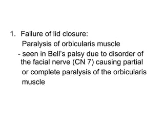 Failure of lid closure: Paralysis of orbicularis muscle - seen in Bell’s palsy due to disorder of the facial nerve (CN 7) causing partial or complete paralysis of the orbicularis muscle 