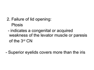 2. Failure of lid opening: Ptosis - indicates a congenital or acquired weakness of the levator muscle or paresis of the 3 rd  CN - Superior eyelids covers more than the iris 