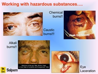 Working with hazardous substances….
Caustic
burns!!!
Chemical
burns!!
Alkali
burns!!
Eye
Laceration
 