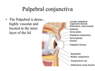 Palpebral conjunctiva
• The Palpebral is dense ,
highly vascular and
located in the inner
layer of the lid
 