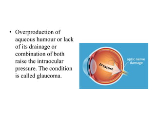 • Overproduction of
aqueous humour or lack
of its drainage or
combination of both
raise the intraocular
pressure. The condition
is called glaucoma.
 