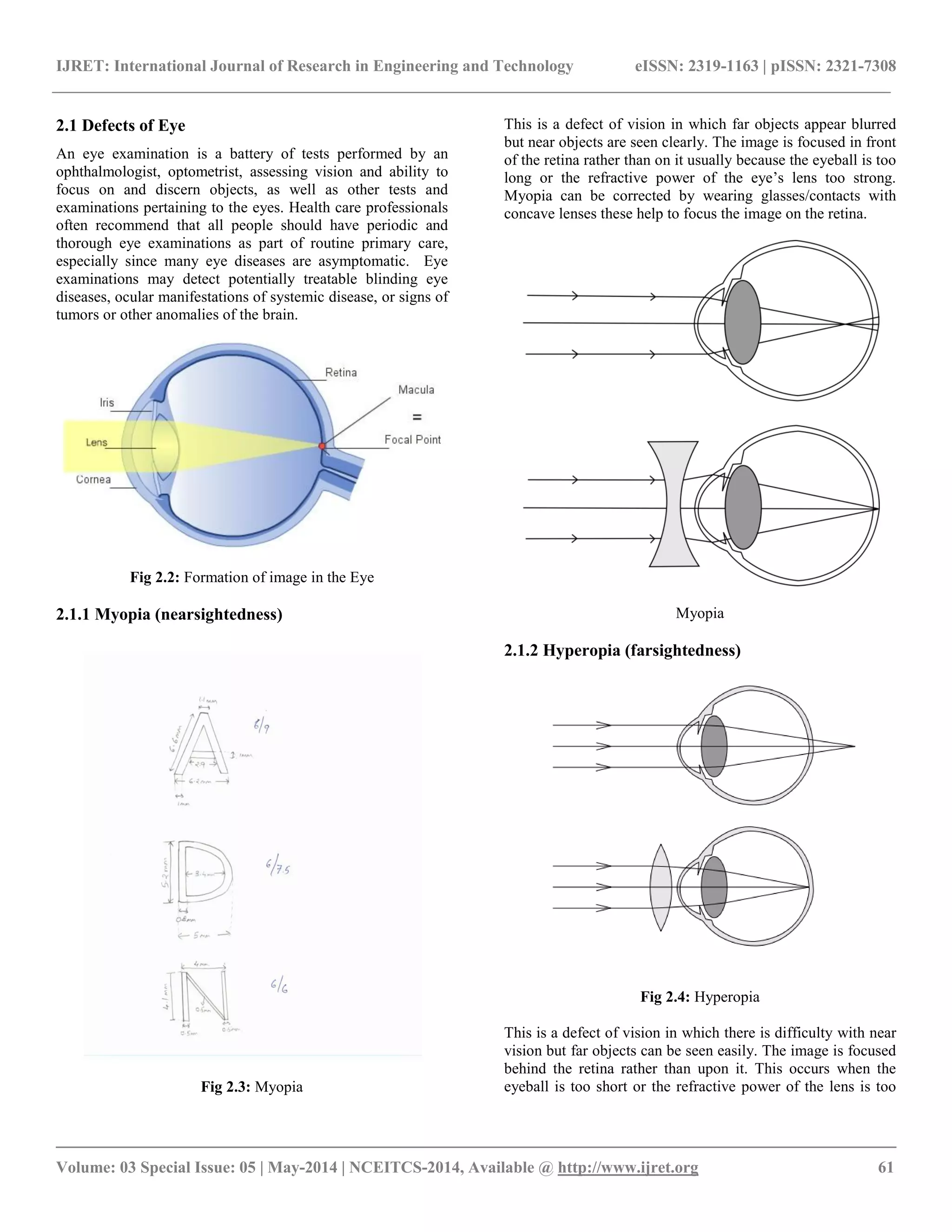 IJRET: International Journal of Research in Engineering and Technology eISSN: 2319-1163 | pISSN: 2321-7308
__________________________________________________________________________________________
Volume: 03 Special Issue: 05 | May-2014 | NCEITCS-2014, Available @ http://www.ijret.org 61
2.1 Defects of Eye
An eye examination is a battery of tests performed by an
ophthalmologist, optometrist, assessing vision and ability to
focus on and discern objects, as well as other tests and
examinations pertaining to the eyes. Health care professionals
often recommend that all people should have periodic and
thorough eye examinations as part of routine primary care,
especially since many eye diseases are asymptomatic. Eye
examinations may detect potentially treatable blinding eye
diseases, ocular manifestations of systemic disease, or signs of
tumors or other anomalies of the brain.
Fig 2.2: Formation of image in the Eye
2.1.1 Myopia (nearsightedness)
Fig 2.3: Myopia
This is a defect of vision in which far objects appear blurred
but near objects are seen clearly. The image is focused in front
of the retina rather than on it usually because the eyeball is too
long or the refractive power of the eye‟s lens too strong.
Myopia can be corrected by wearing glasses/contacts with
concave lenses these help to focus the image on the retina.
Myopia
2.1.2 Hyperopia (farsightedness)
Fig 2.4: Hyperopia
This is a defect of vision in which there is difficulty with near
vision but far objects can be seen easily. The image is focused
behind the retina rather than upon it. This occurs when the
eyeball is too short or the refractive power of the lens is too
 