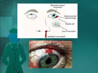 Eyes injury | PPT