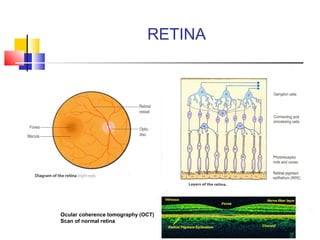 RETINA
Ocular coherence tomography (OCT)
Scan of normal retina
 