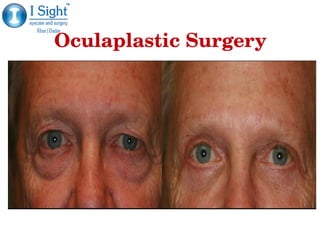Oculaplastic SurgeryOculaplastic Surgery
 