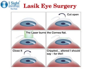 Lasik Eye SurgeryLasik Eye Surgery
 
