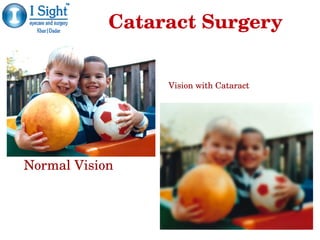 Normal VisionNormal Vision
Vision with CataractVision with Cataract
Cataract SurgeryCataract Surgery
 