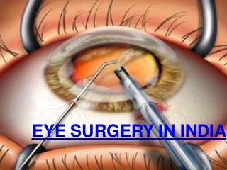 EYE SURGERY IN INDIA

 