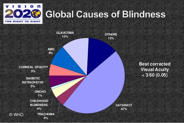 Eye Diseases Chart