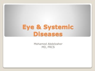Eye & Systemic
Diseases
Mohamed Abdelzaher
MD, FRCS
 