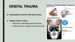 ORBITAL TRAUMA
■ Assess globe of eye for soft tissue injury.
■ Assess contour of face:
– May have underlying facial fractures.
– If blunt trauma, suspect facial fractures.
 
