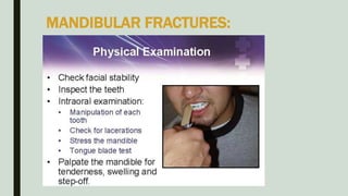 MANDIBULAR FRACTURES:
 