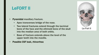 • Pyramidal maxillary fracture.
• Apex transverses bridge of the nose.
• Two lateral fractures extend through the lacrimal
bone of the face and the ethmoid bone of the skull
into the median area of both orbits.
• Base of fracture extends above the level of the
upper teeth into the maxilla.
• Possible CSF leak, rhinorrhea
LeFORT II
 